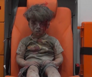 Omran Daqneesh, 5-year-old was rescued from rubble on August 17, 2016 Photo: Screenshot/MSNBC